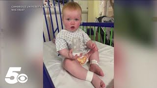 Toddler regains hearing through revolutionary gene therapy