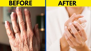 The Ultimate Hand Transformation | Best Remedy for Dryness and Wrinkles
