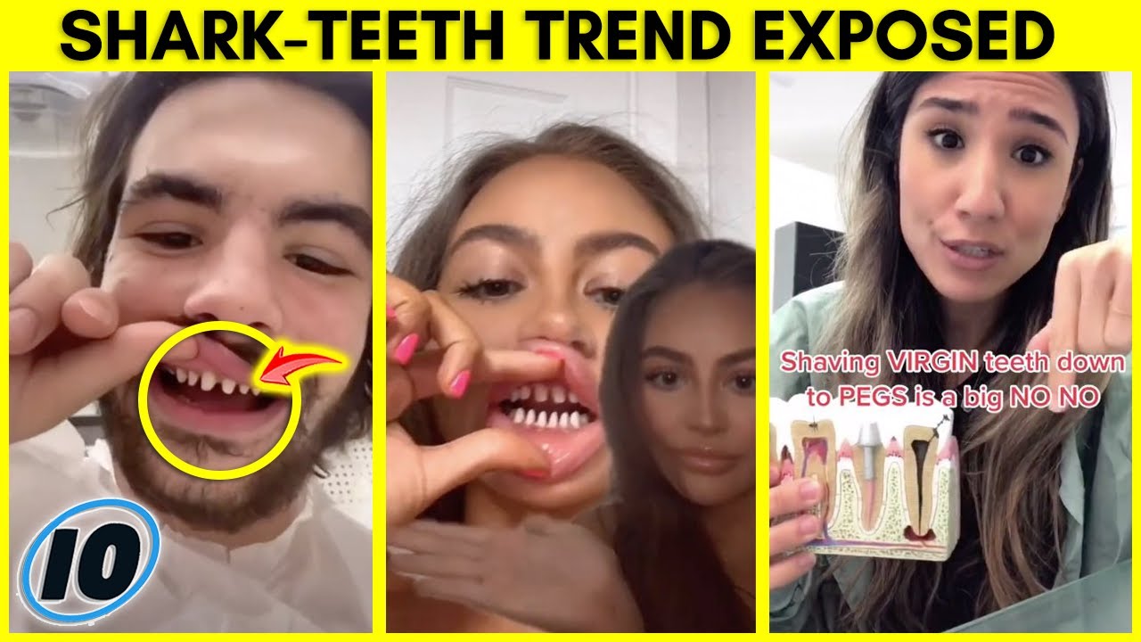 Dentists Shocked By This Dangerous TikTok Trend