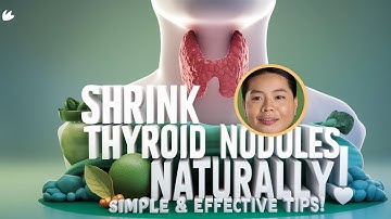 Thyroid Nodules - Causes And Natural Ways To Shrink Thyroid Nodules| Hypothyroidism | Thyroid