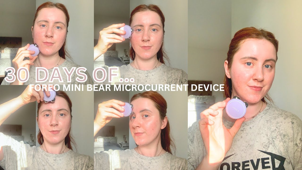 30 Days OfForeo Mini Bear Microcurrent Device, Before & After
