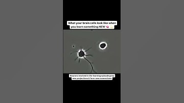 Thumbnail of What your brain cells look like when you learn something NEW #shorts #neuroscience #neuroplasticity