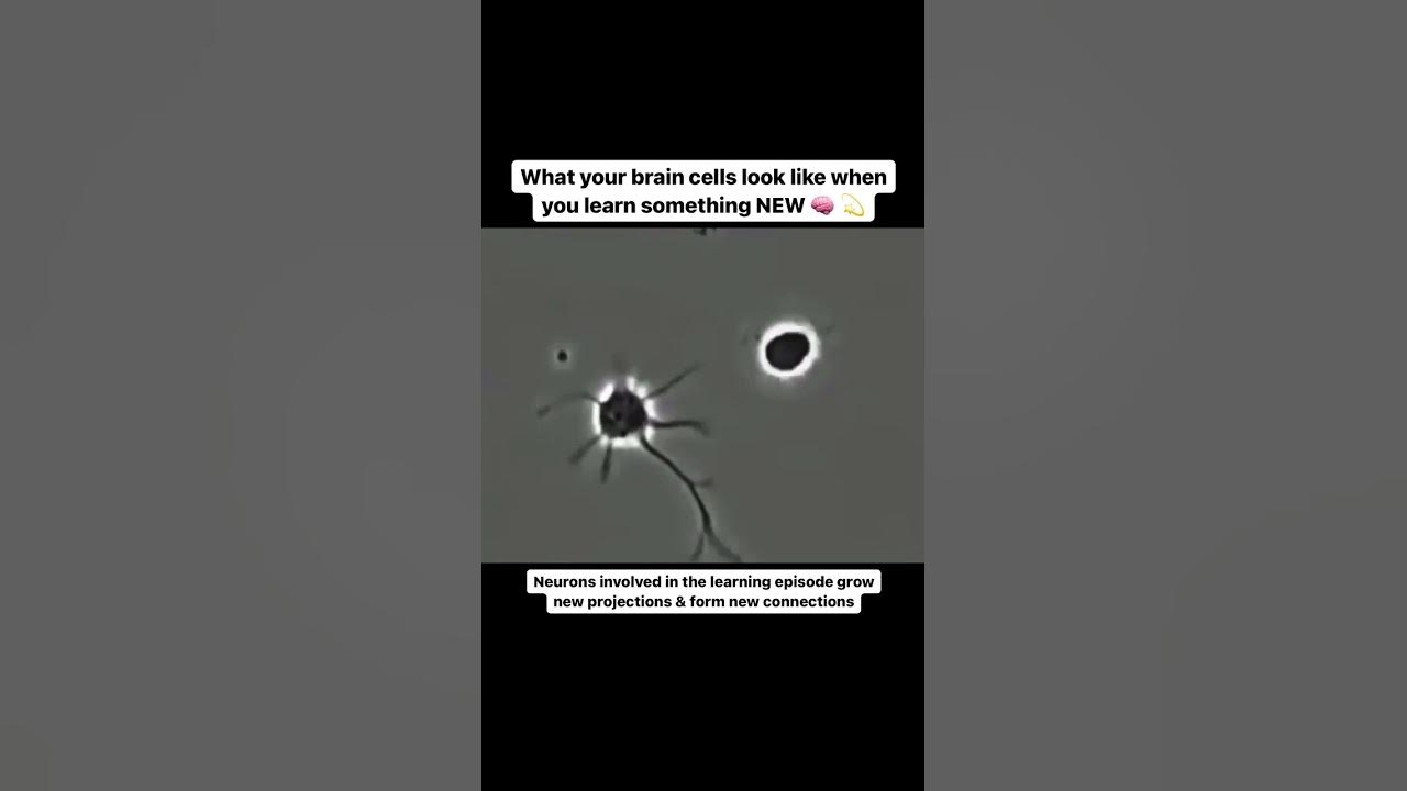 What your brain cells look like when you learn something NEW #shorts #neuroscience #neuroplasticity What your brain cells look like when you learn something NEW #shorts #neuroscience #neuroplasticity