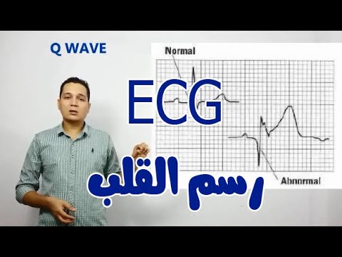 ازاى تقرا رسم القلب(مراجعة سريعة) how to read ECG