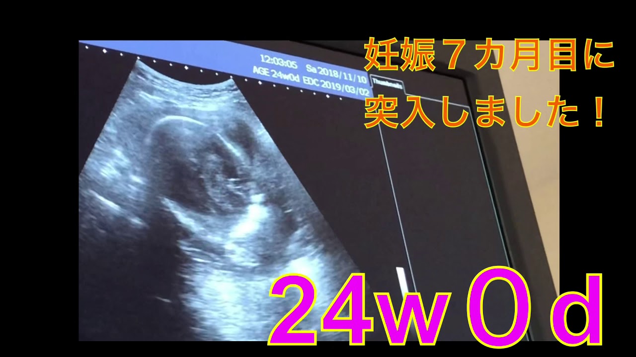 妊娠中期エコー 24w0d 7カ月目突入 Youtube 妊娠中期エコー 24w0d 7カ月目突入 Youtube