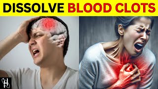 9 EVERYDAY FOODS That Naturally Dissolve Blood Clots