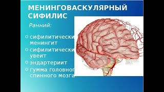 Психические расстройства при сифилитическом поражении головного мозга