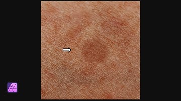 Creating a skin spot in a photo using Blend Options/Blend Ranges | Affinity Photo