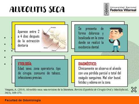 Vídeo: Alveolitis Fibrosante Idiopática: Guías Clínicas, Información General