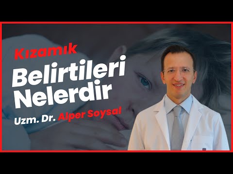 Kızamık Belirtileri Nelerdir? Kızamık Tedavisi Nasıl Yapılır? - Dr. Alper Soysal