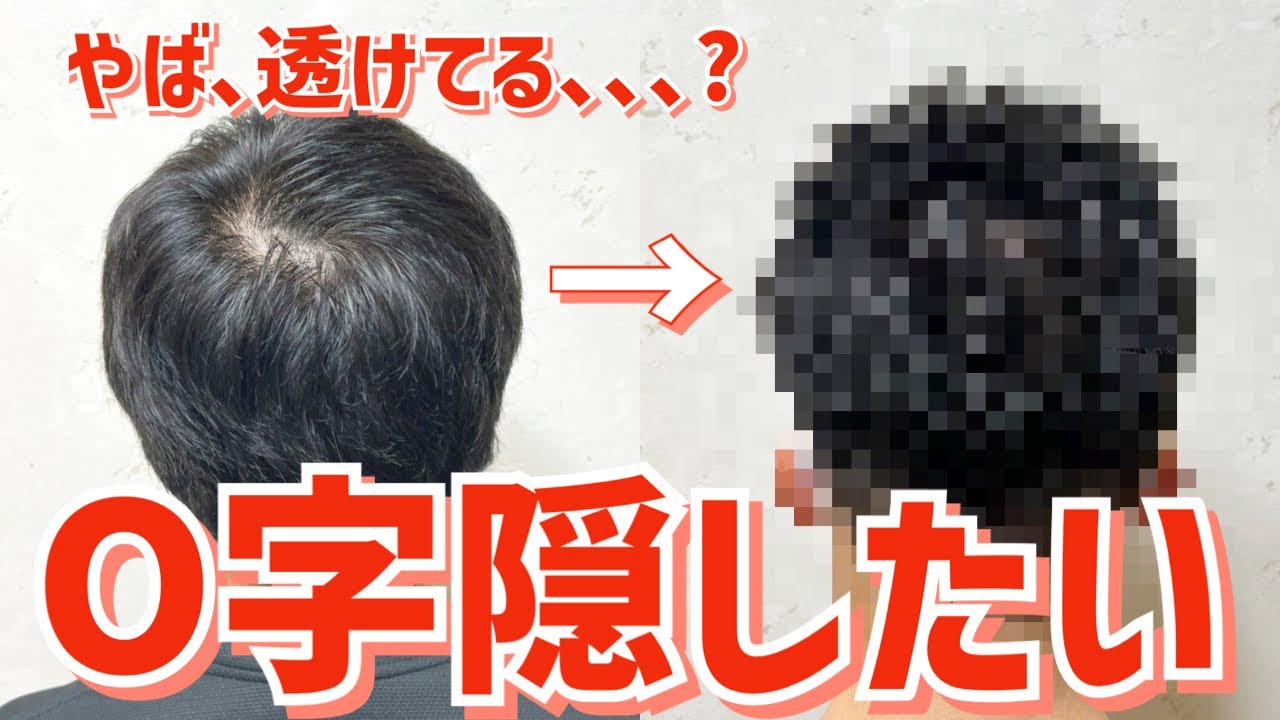 【薄毛】つむじはげをカットとセットでカバー!爽やかイケメンに変身! YouTube