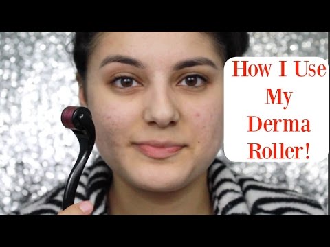 Acne Scar Sunday #: How I Use My Derma Roller! Week 