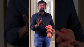 உள பரசதன எபபத தவ ? Pv 95 % சக பரசவம -Blood Supply