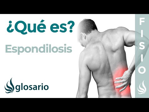 Vídeo: Espondilosis De La Columna Vertebral: ¿qué Es? Etapas, Síntomas Y Tratamiento