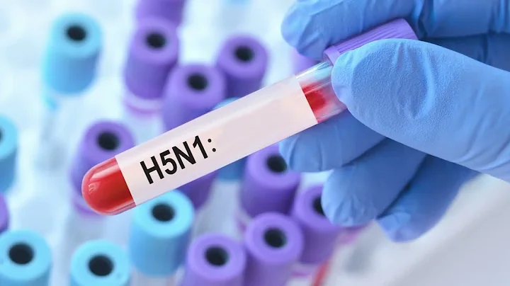 What You Need to Know About Bird Flu in California