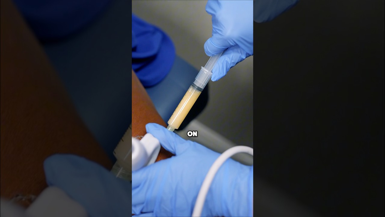 How to alleviate chronic knee pain? #painrelief #kneepain #painmanagement