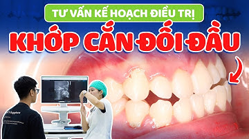 Niềng Răng Khấp Khểnh, Cắn Đối Đầu: Khỏi 100% Với Kế Hoạch Điều Trị Siêu Chi Tiết | Lạc Việt Intech