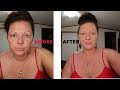 FULL COVERAGE MAKEUP FOR Melasma,Hyperpigmentation,Dark Spots,Freckles,Discoloration