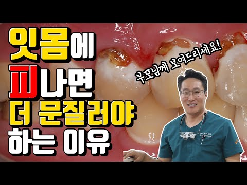 잇몸에서 피나는 이유 (feat.해결법 공개!)