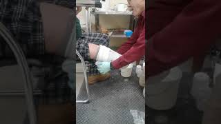 My casting for my prosthetic leg (Part2)
