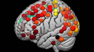Nodes and Edges: Adolescent consolidation of the hubs of the human brain connectome