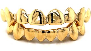 Gold Grillz that Look Like Your Real Teeth by Seattle Gold Grills