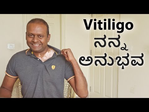 Vitiligo My Experience World Vitiligo Day ವಿಟಿಲ್‍ಗೋ-ತೊನ್ನು ಹಾಲ್ಚರ್ಮ ಬಿಳಿ ಮಚ್ಚೆ