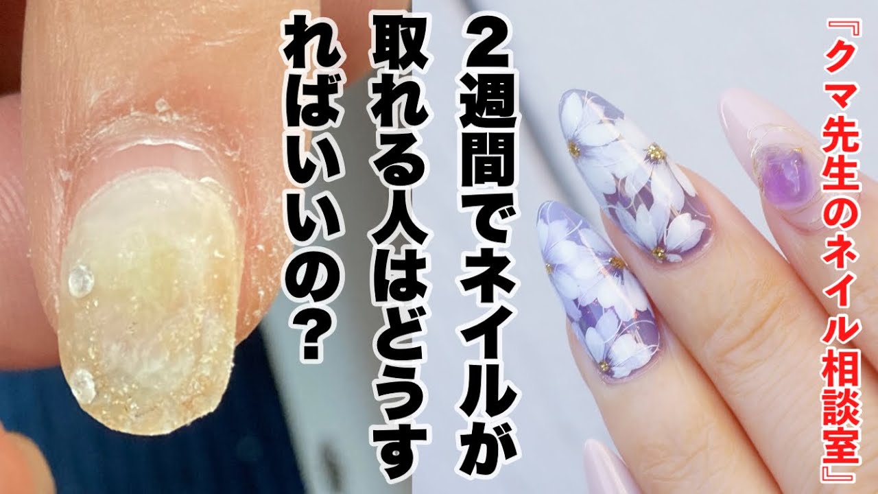 ２週間でネイルが取れる人どうすればいいの ネイル相談室 くま先生のネイルtv 168 Youtube