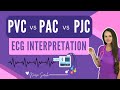 Understanding PVCs, PACs, and PJCs