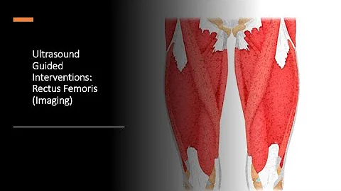 #ultrasound Guided Interventions: Rectus Femoris (Imaging)