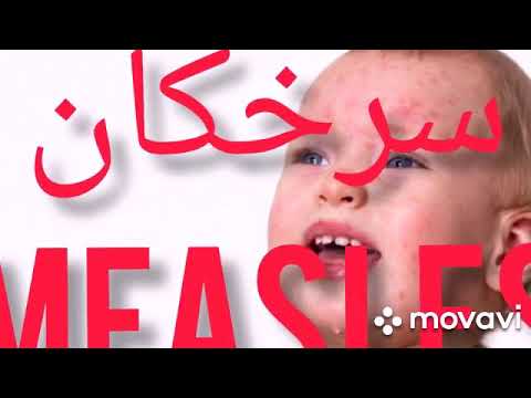 تصویری: سرخک در کودکان: علائم و درمان