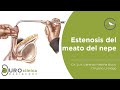 Dilatacion de meato uretral por estenosis de meato uretral