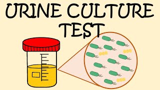 URINE CULTURE TEST - HOW TO COLLECT URINE SAMPLE