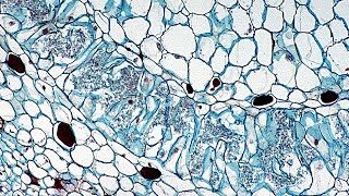 Practical Importance of Human Evolution - Superorganisms - Human Microbiome