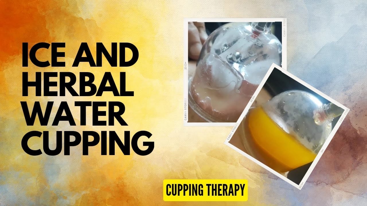 Ice 🧊 & Herbal Cupping