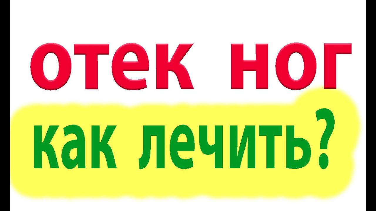 Отекли ноги. Что делать? Как лечить отек ног#малиновский - YouTube