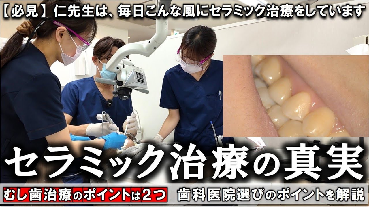 セラミック治療の真実…