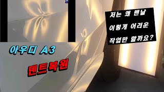 왜 자꾸 어려운 덴트만 하게 되는지 모르겠네요#덴트#수원덴트#덴트잘하는집