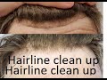 Hair replacement, Hairline clean up tutorial, hair system maintenance