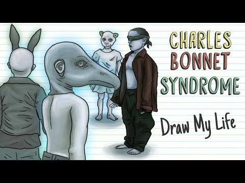 CHARLES BONNET SYNDROME | Draw My Life