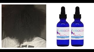 I TRIED KALEIDOSCOPE MIRACLE DROPS FOR A MONTH | do they work?