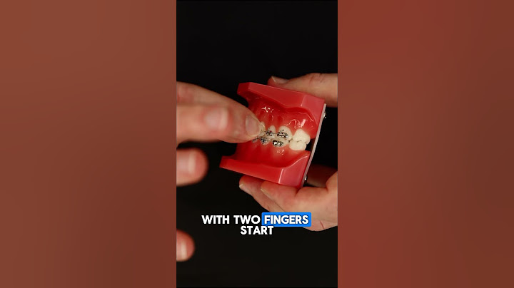Putting on rubber bands. #rubberbands