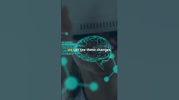 What Makes You ‘YOU’? The Truth About Consciousness 🧠 #shorts #ytshorts #neuroscience #mind #facts