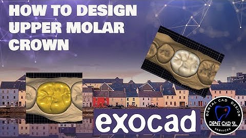 exocad upper molar crown design