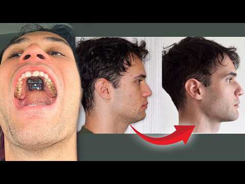 Looksmaxxer splits skull in half to look better | Interview w @AsherLite2000