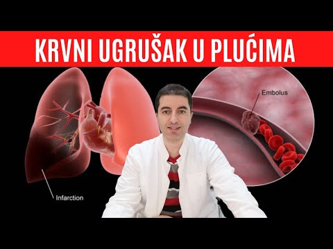 Video: Krvni Ugrušak U Plućima Kod Pasa