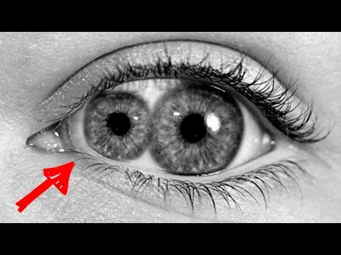 10 СТРАННЫХ ГЕНЕТИЧЕСКИХ МУТАЦИЙ