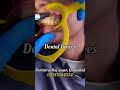 Braces Treatment at Dentistree Complete Dental Clinic Raj nagar, Ghaziabad #alignersforteeth #braces