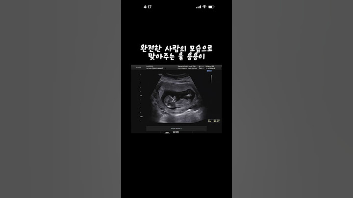 41세 두찌맘의 #임신브이로그 #12주차 #초음파검사 #청룡맘 #임산부vlog #행복한일상