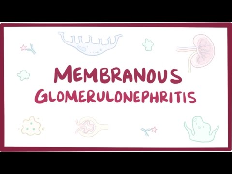 Vidéo: Glomérulonéphrite Membraneuse: Causes, Symptômes Et Diagnostic